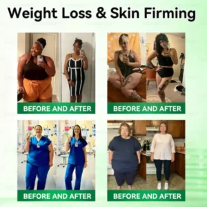 RZXEA™ Moringa & Berberine NAD+ 10-in-1 Nano Microneedle Patch (Just once a day, visible changes in 7 days) ✅ For obesity, loose skin, diabetes, sleep apnea, joint issues, and more