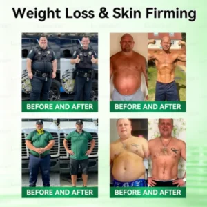RZXEA™ Moringa & Berberine NAD+ 10-in-1 Nano Microneedle Patch (Just once a day, visible changes in 7 days) ✅ For obesity, loose skin, diabetes, sleep apnea, joint issues, and more